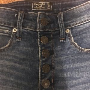 Abercrombie Button-Fly High-Rise Skinny Jeans